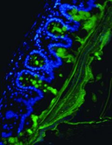 Una gruesa capa de mucosa, generada por las células de la pared del colon, proporciona protección contra las bacterias invasoras y otros patógenos. Esta imagen del colon de un ratón muestra la mucosa (verde) actuando como una barrera para las células (azul) que la producen.