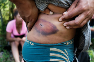 La violencia es común en la ruta migrante. Aquí, un hombre muestra una herida que sufrió en el tren. Crédito de la imagen: Jason De León.