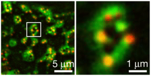 Dos micrografías, una junto a la otra, muestran estructuras proteicas recién descubiertas en forma de anillo que se unen a membranas celulares. La imagen de la izquierda está más alejada y muestra muchas estructuras, mientras que la de la derecha muestra un solo anillo en primer plano (los anillos miden aproximadamente un micrómetro de diámetro). Los anillos se asemejan a collares tipo gargantilla. La "cadena" está formada por proteínas que brillan en verde y ayudan a anclar el anillo a la membrana celular. La cadena está marcada por unas seis "joyas" rojas, que son canales orientados a través de la membrana.
